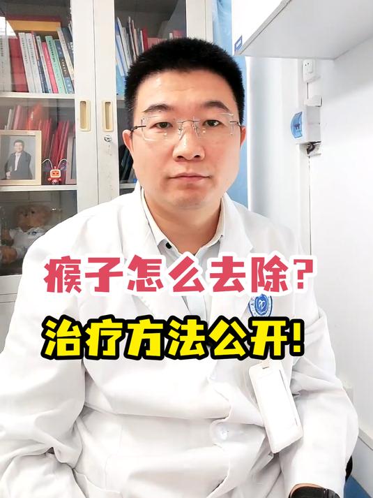 瘊子怎么去除?治疗方法公开!
