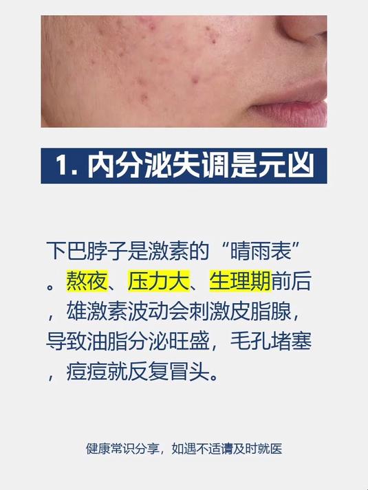 下巴和脖子反复长痘痘是什么原因