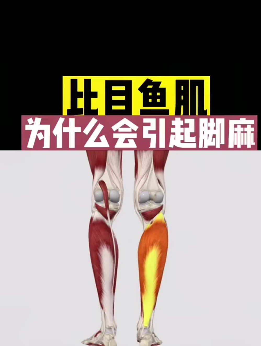 比目鱼肌管你知道吗?为什么会引起脚麻?