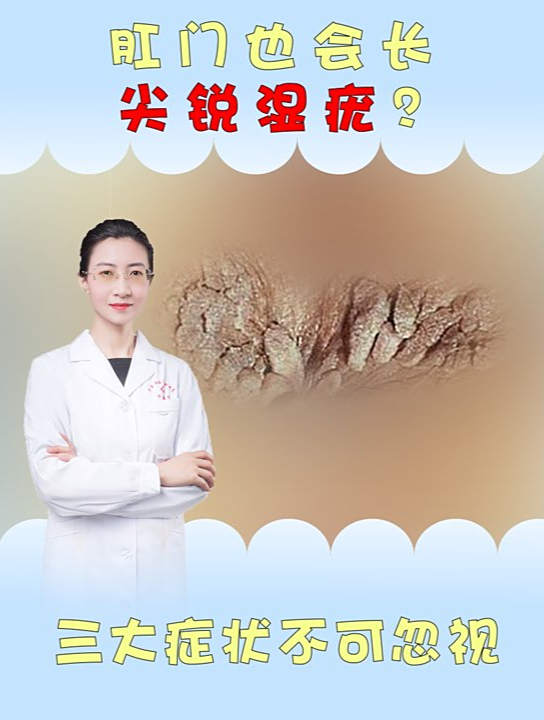 肛门也会长尖锐湿疣?医生:三大症状不可忽视!同性异性都有可能