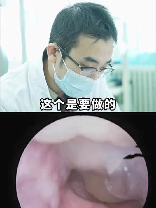 鼻息肉尽早手术越拖创伤越大