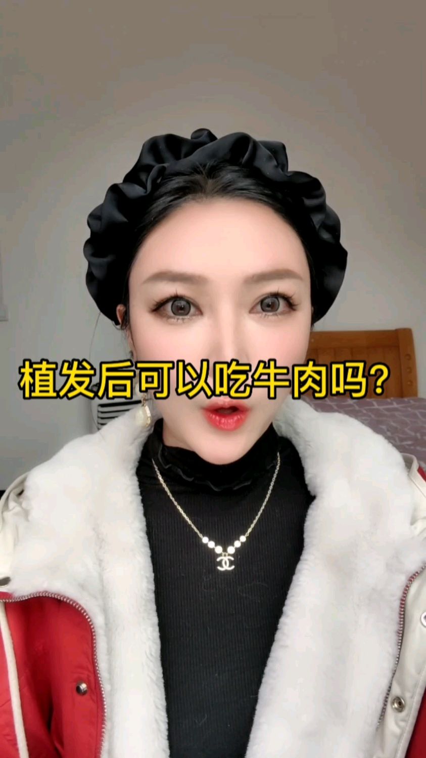 植发后可以吃牛肉吗