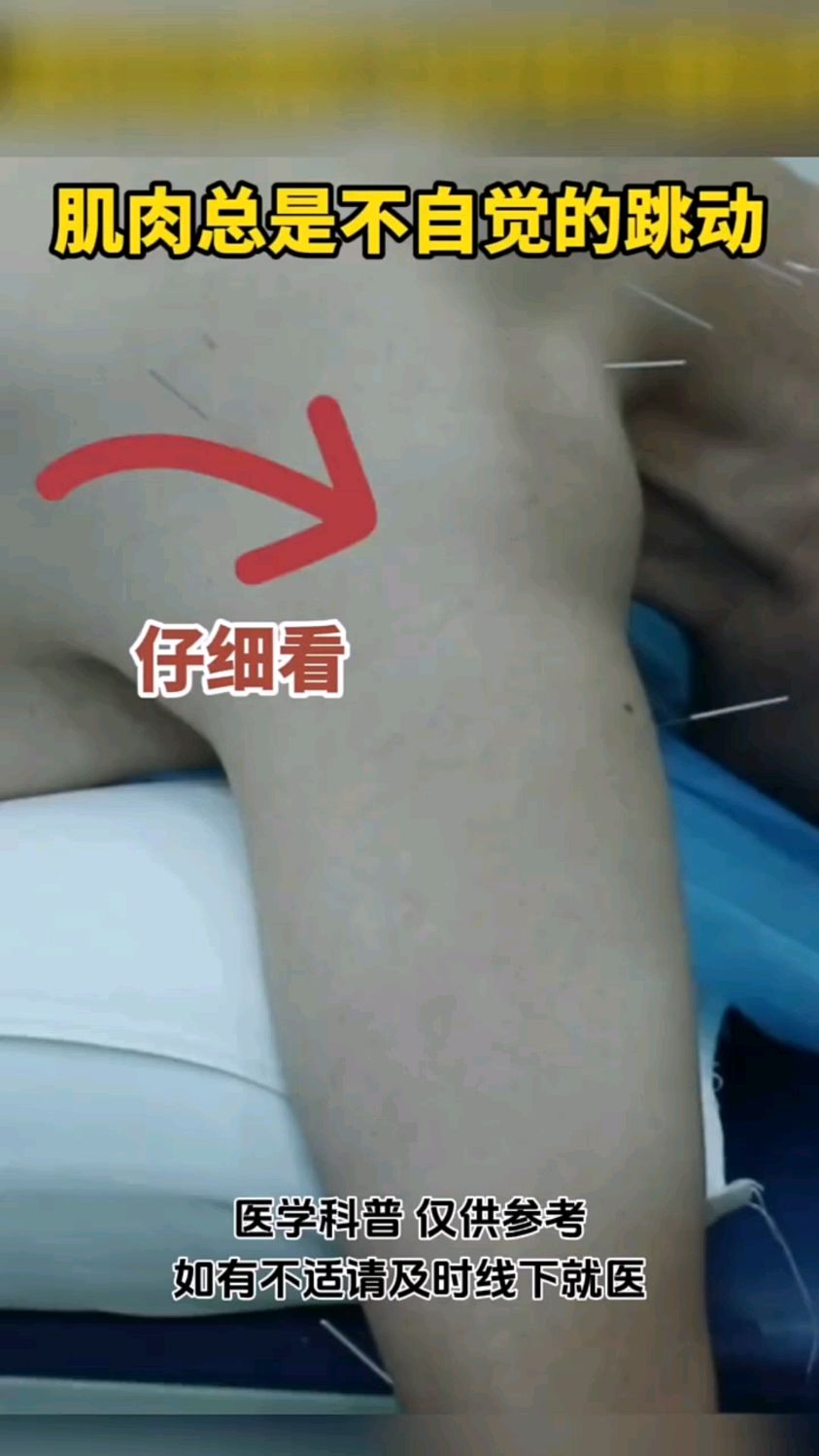 肌肉总是不自觉的跳动