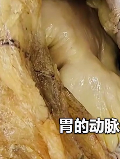 人体结构:胃动脉