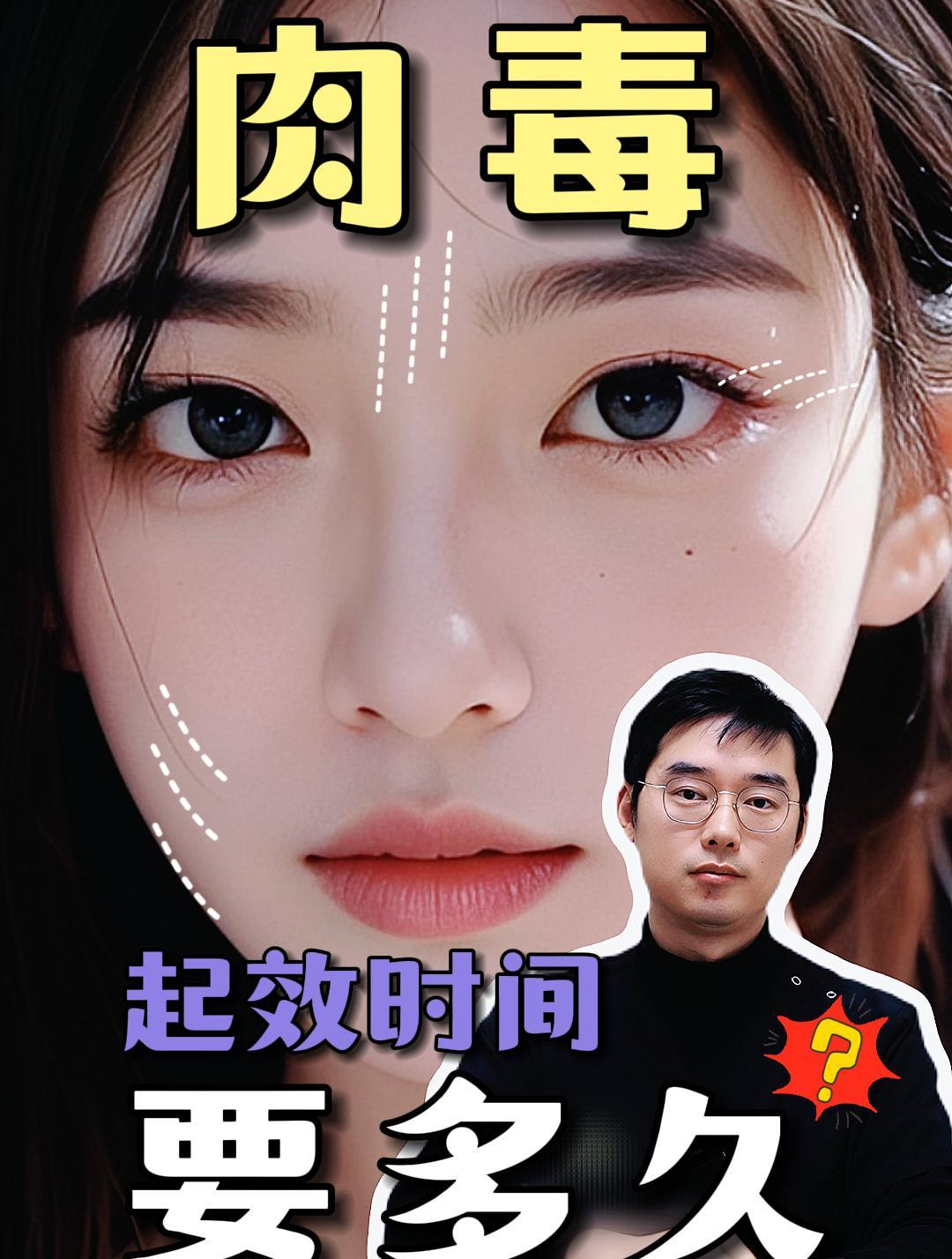 肉毒素起效要多久?