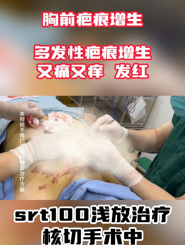 小伙子胸前长出一块块肉疙瘩,做梦都想弄没了