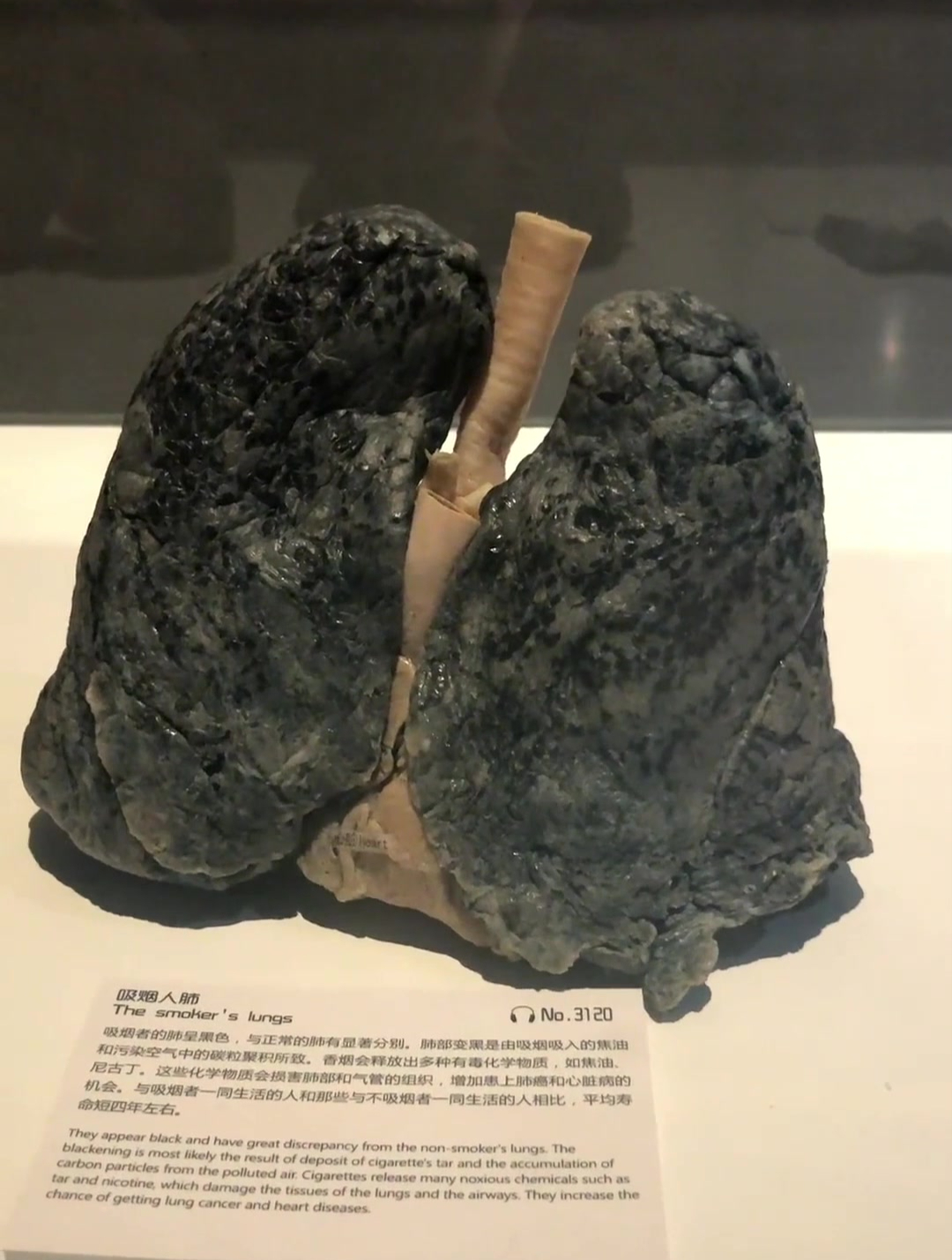 吸烟人的肺什么样子