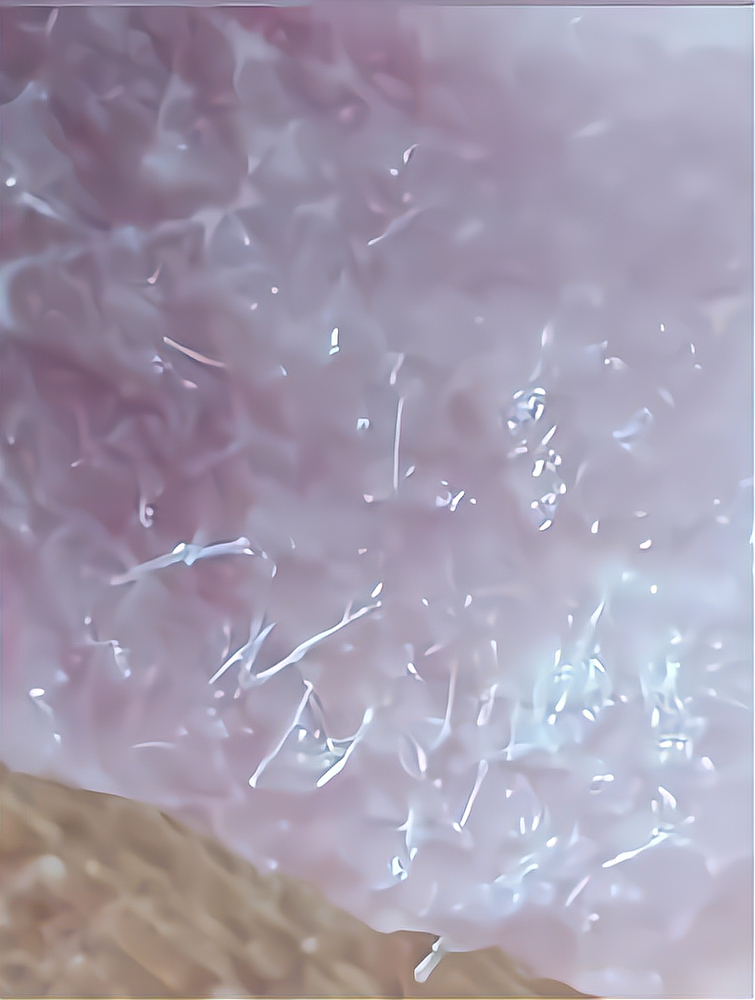 猪肉还能吃吗?这密密麻麻的白丝是什么?