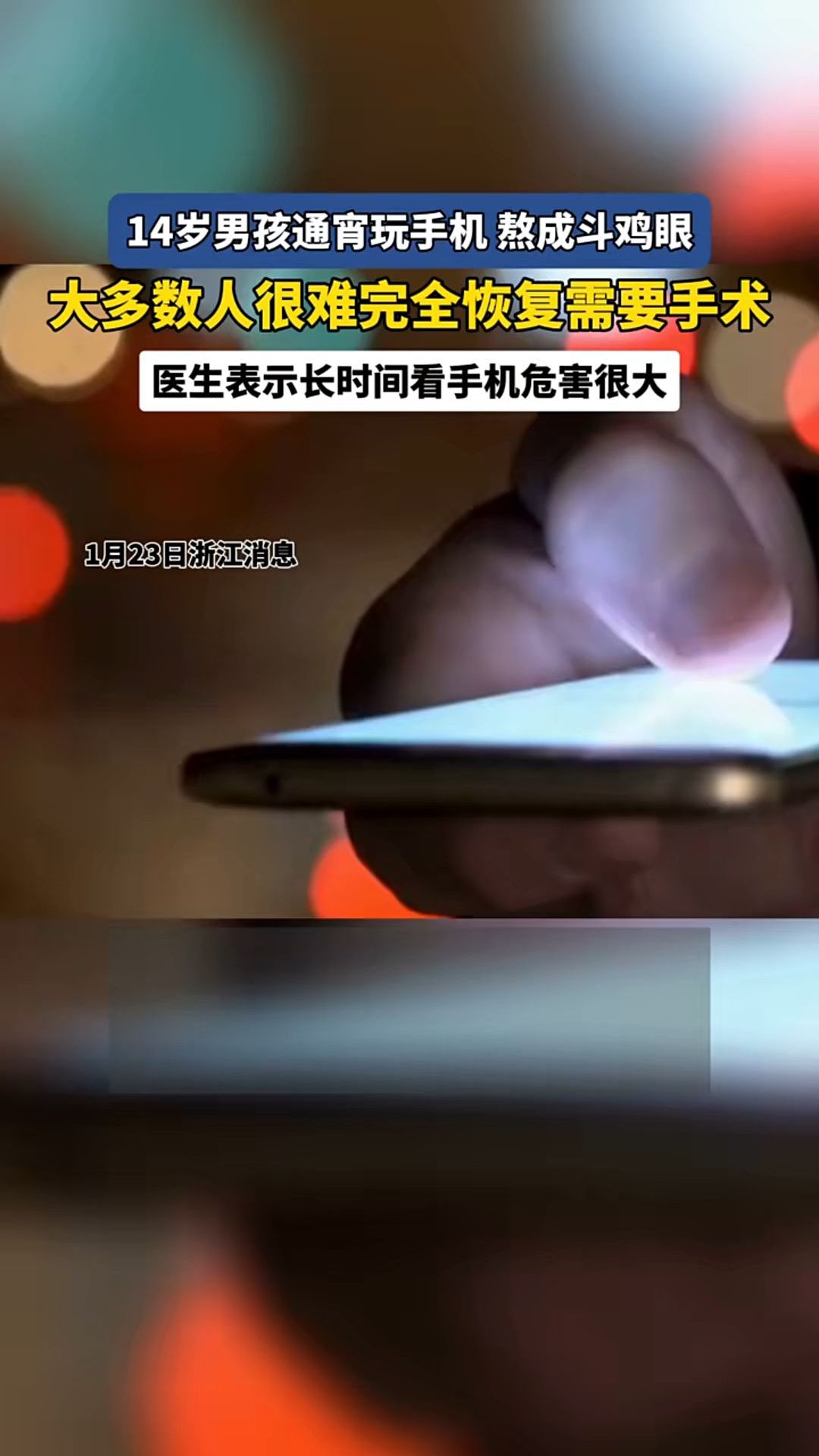 14岁男孩通宵玩手机打游戏 熬成斗鸡眼