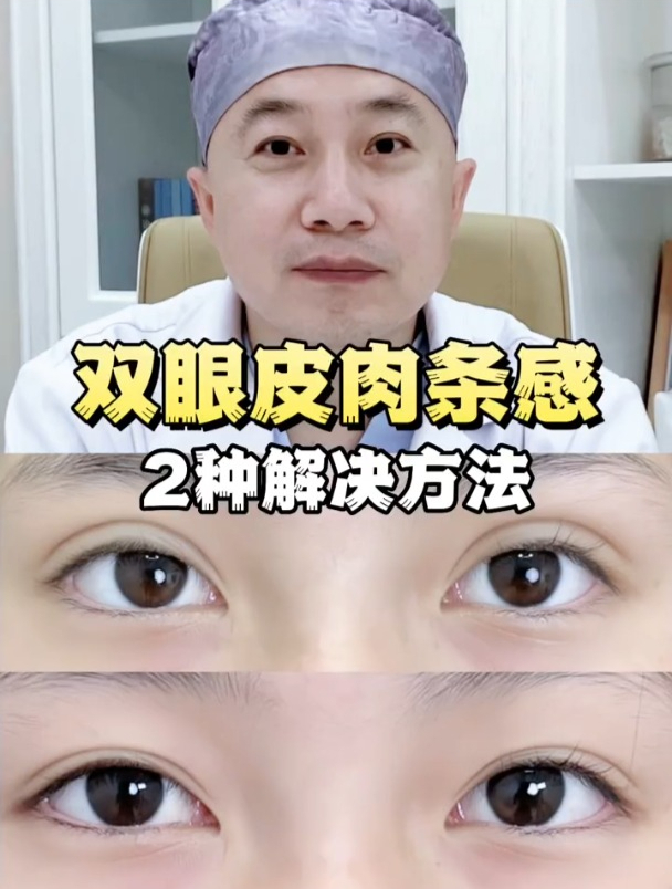双眼皮肉条感2种解决方法!