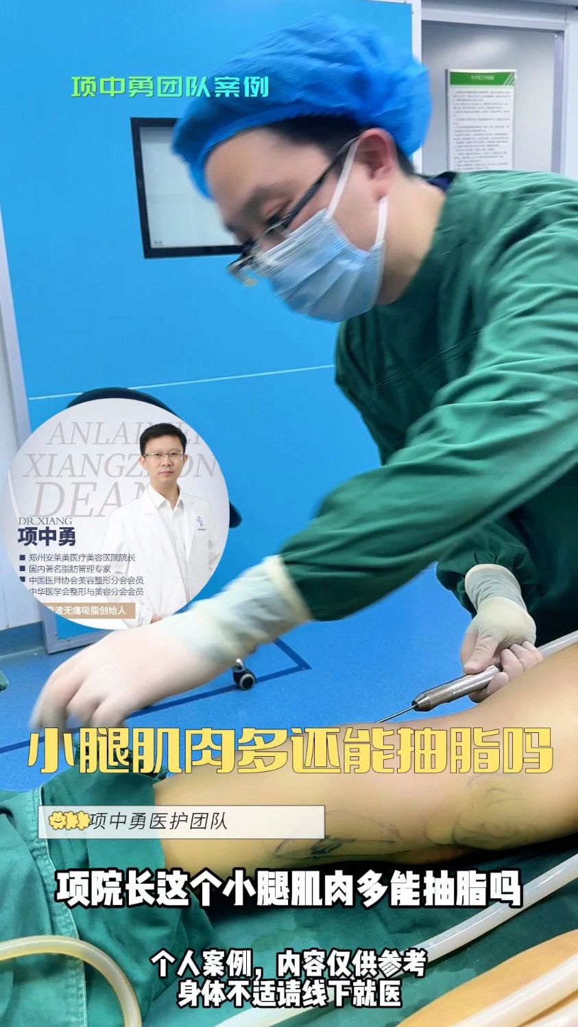小腿抽脂,肌肉多还能抽吗