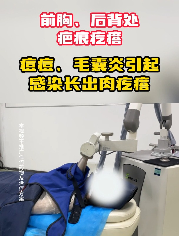 前胸后背痘痘变肉疙瘩,女生仅两年增生一片