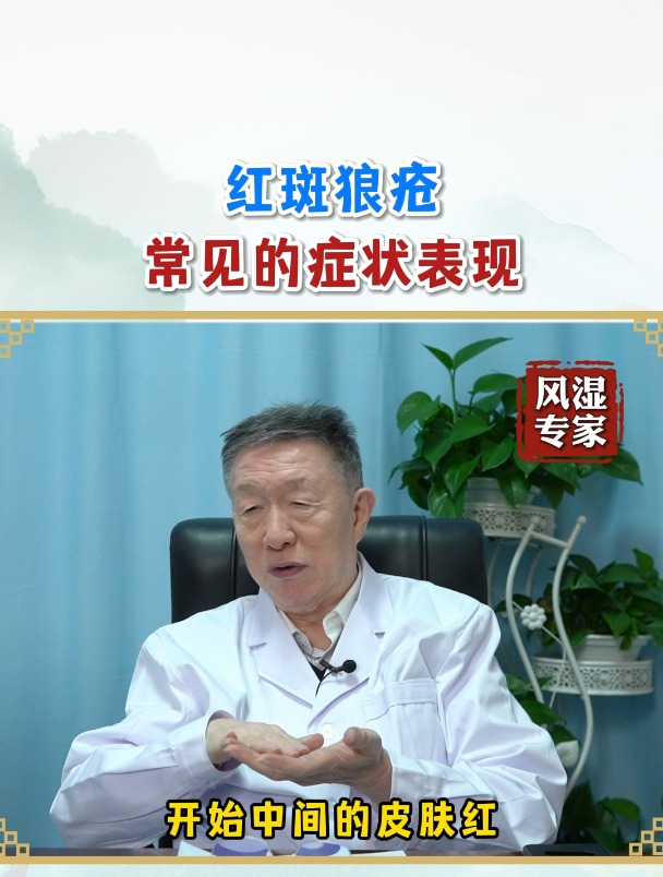 红斑狼疮常见的症状表现