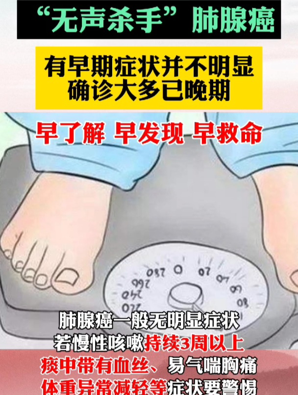 肺腺癌早期没有什么症状,一旦发现大多都已经是晚期!