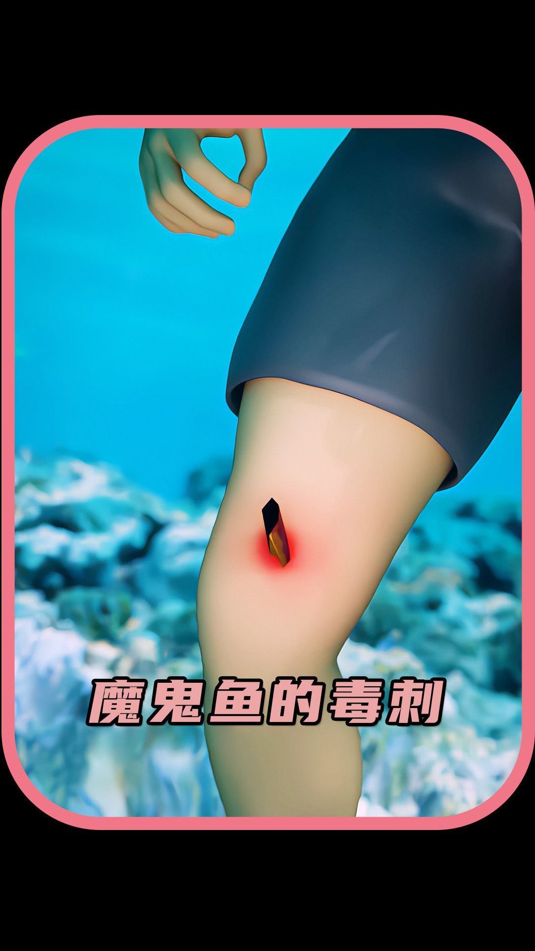 魔鬼鱼的毒刺毒性有多强?