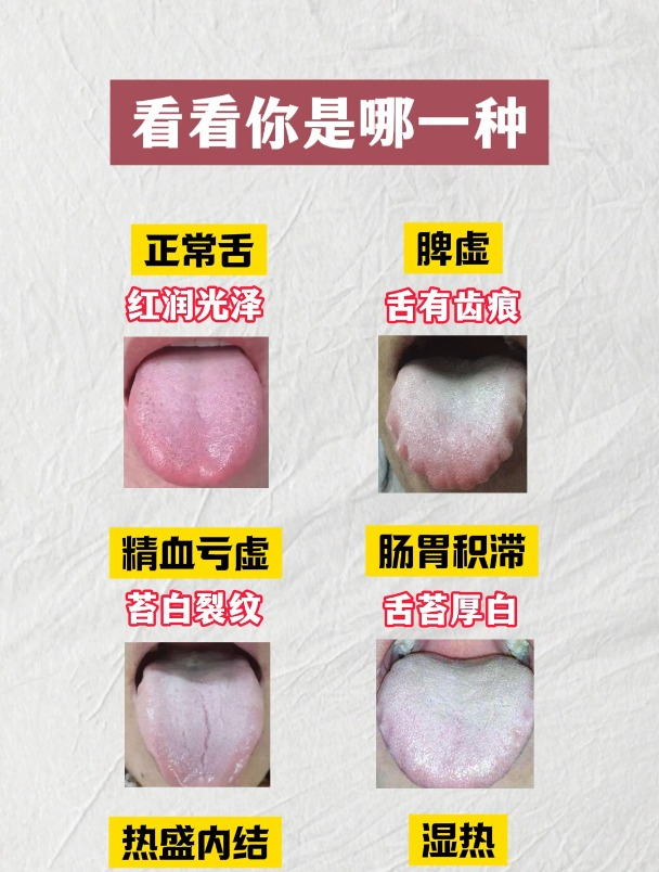 正常的舌苔长这样!
