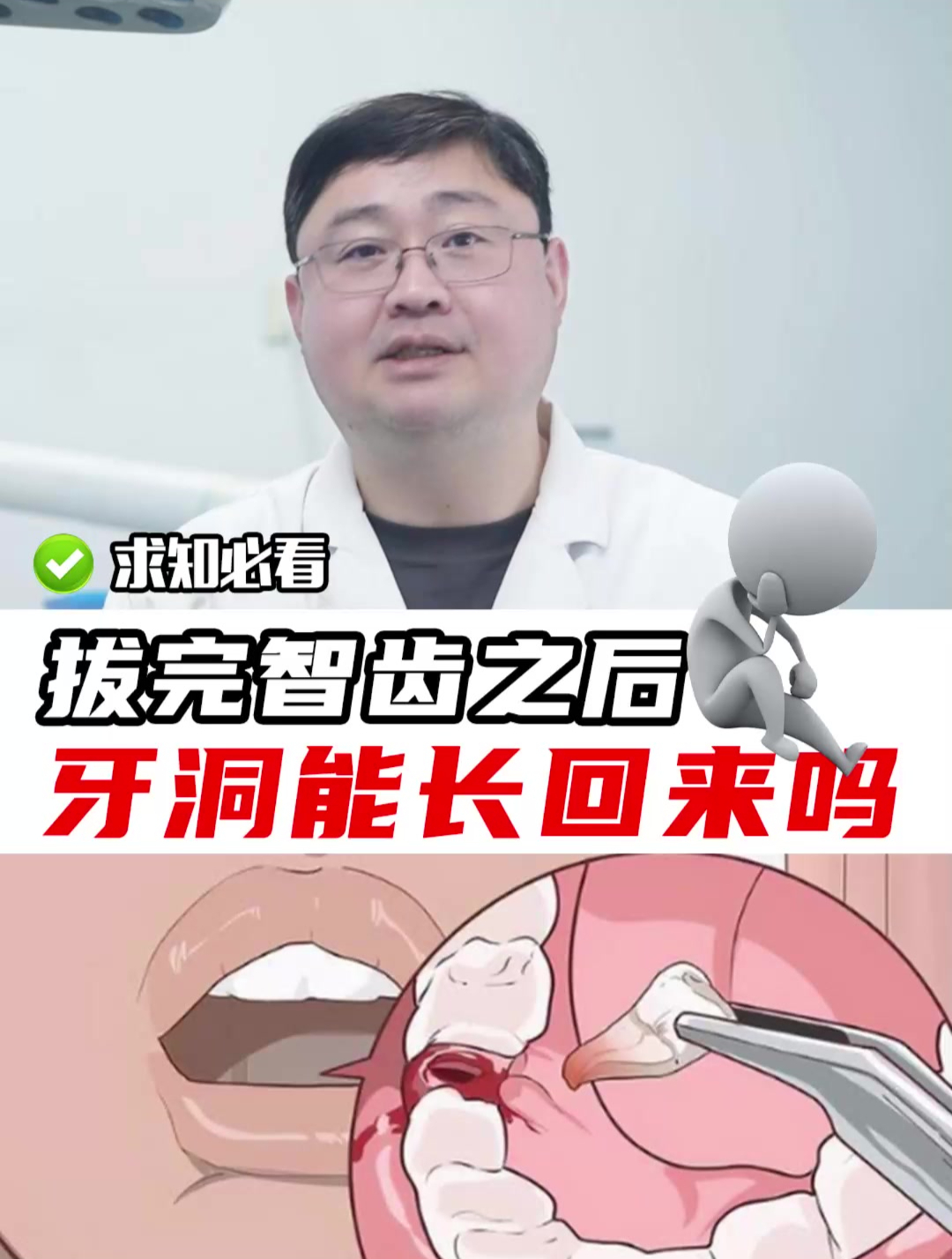 拔完智齿之后,牙洞能长回来吗?