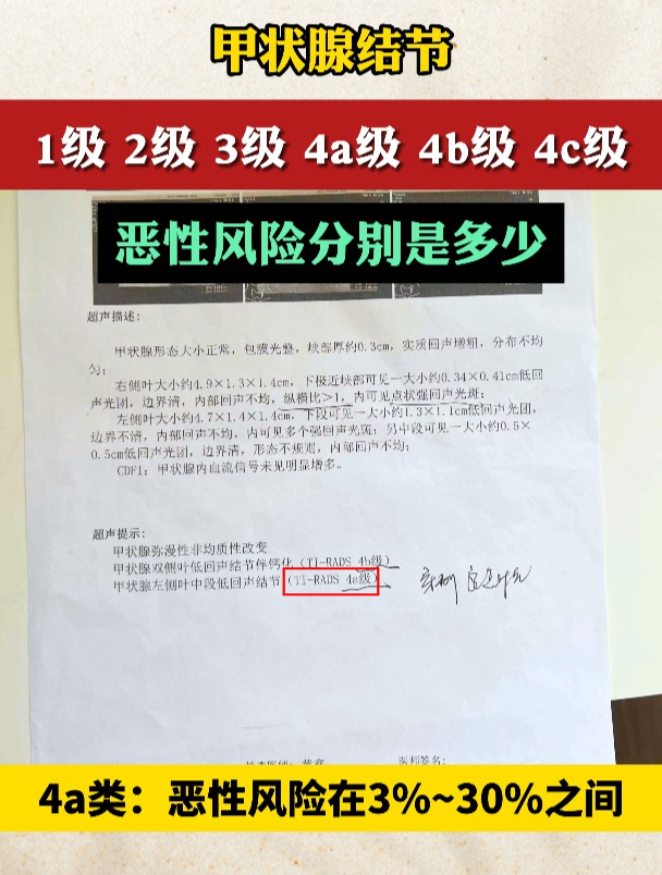 甲状腺彩超报告你会看吗?