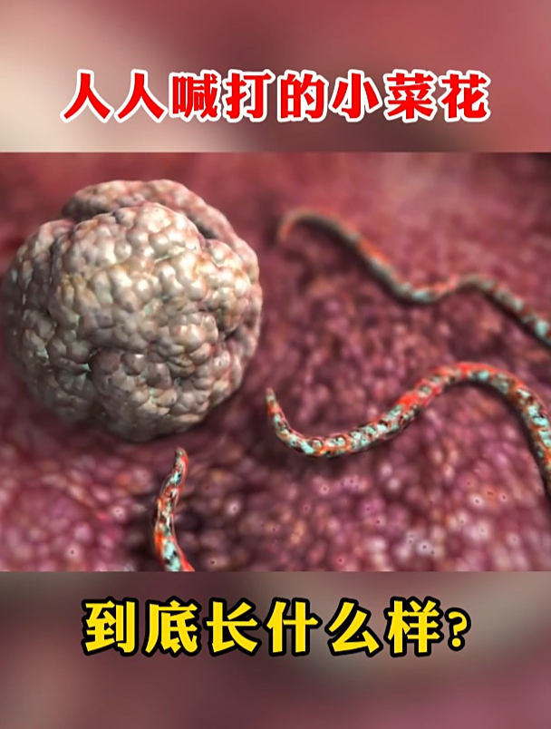 人人喊打的小菜花 到底长什么样?