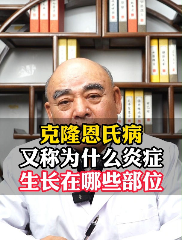 克隆恩氏病又称为什么炎症,生长在哪些部位