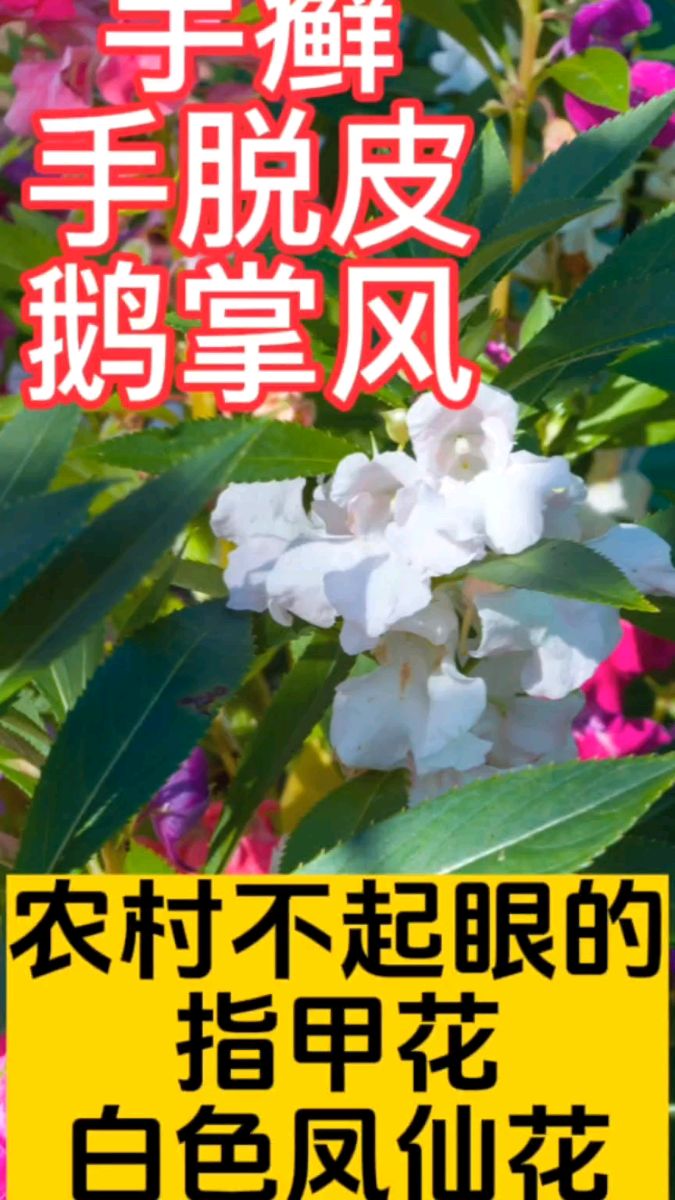 手癣手脱皮鹅掌风—农村不起眼的指甲花(白色凤仙花)