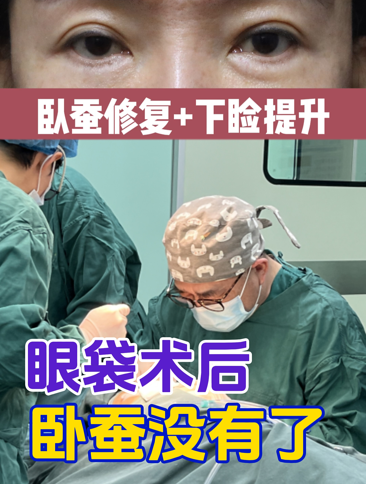 眼袋手术后,下眼睑退缩、卧蚕不见了,修复后能恢复原来吗?