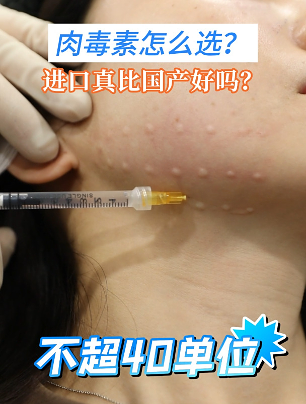 肉毒素选择:进口VS国产。