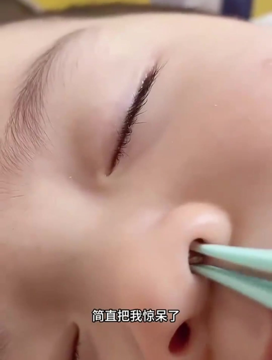 宝宝鼻孔里有东西