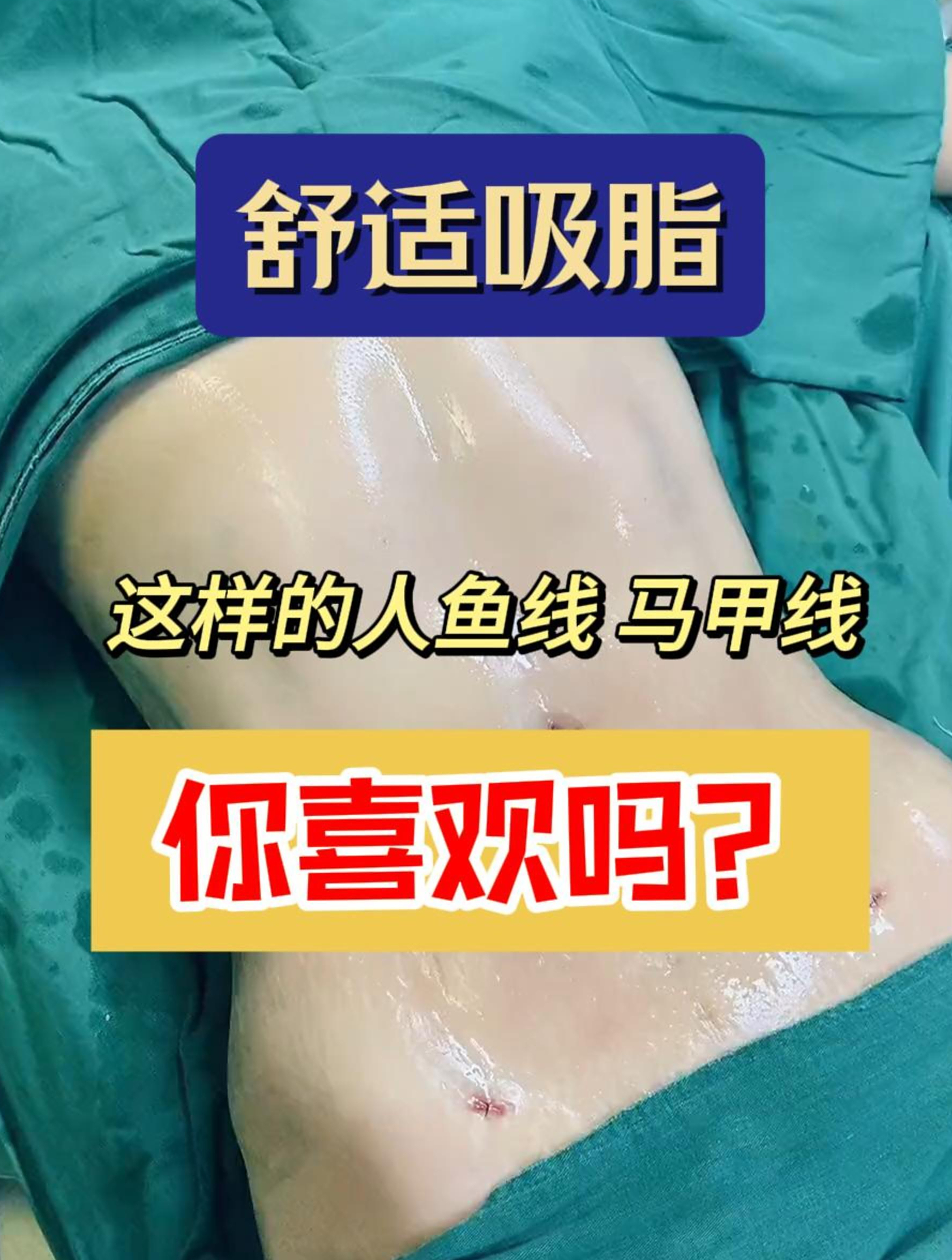 这样的人鱼线,马甲线你喜欢吗?