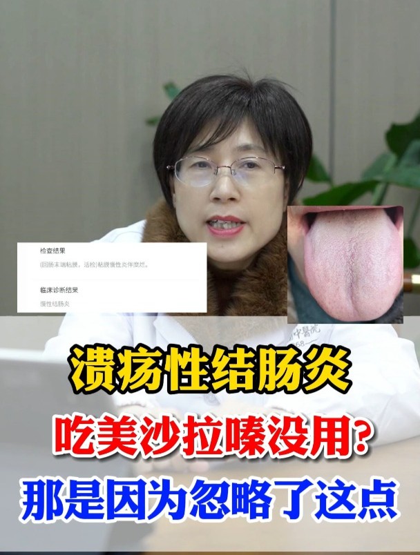 溃疡性结肠炎,吃美沙拉嗪没用?那是因为忽略了这点