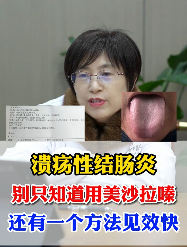 溃疡性结肠炎,别只知道用美沙拉嗪,还有一个方法见效快