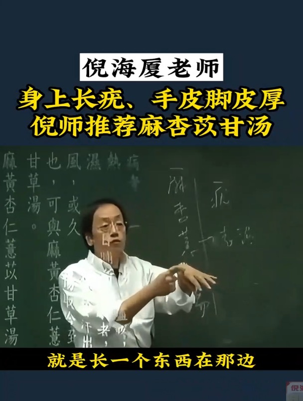 倪海夏:手皮脚皮厚,试试麻杏苡甘汤