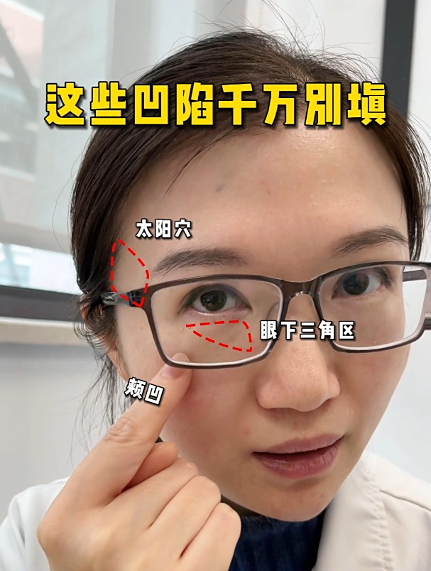 这些凹陷千万别填!轮廓提升