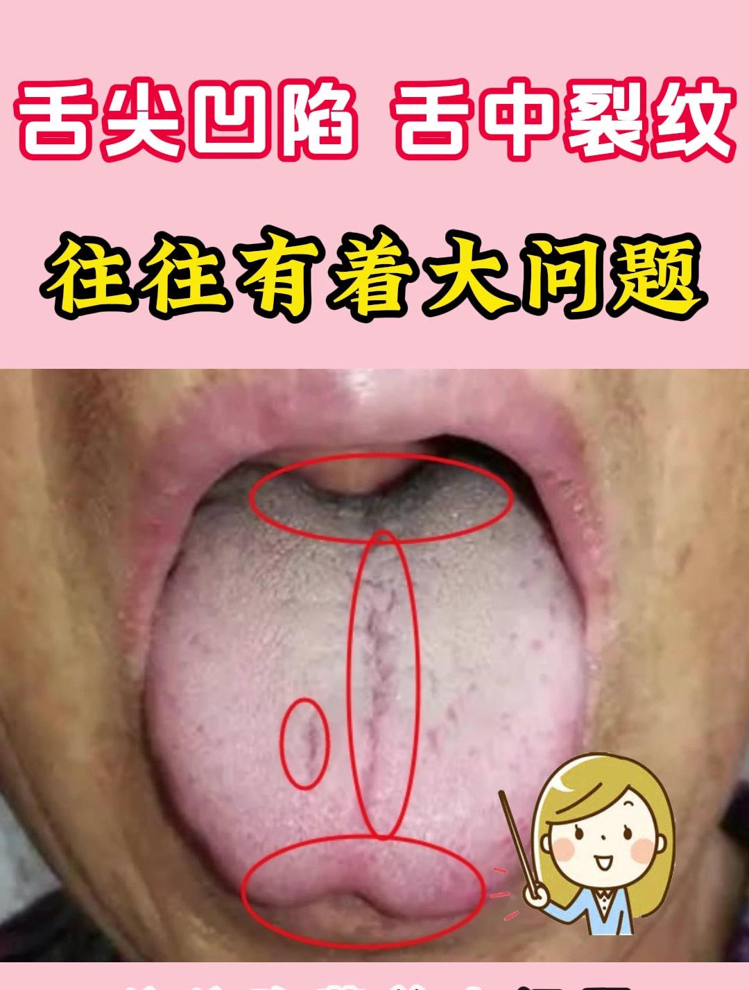 舌根凹陷,疲软无力,往往有着大问题!