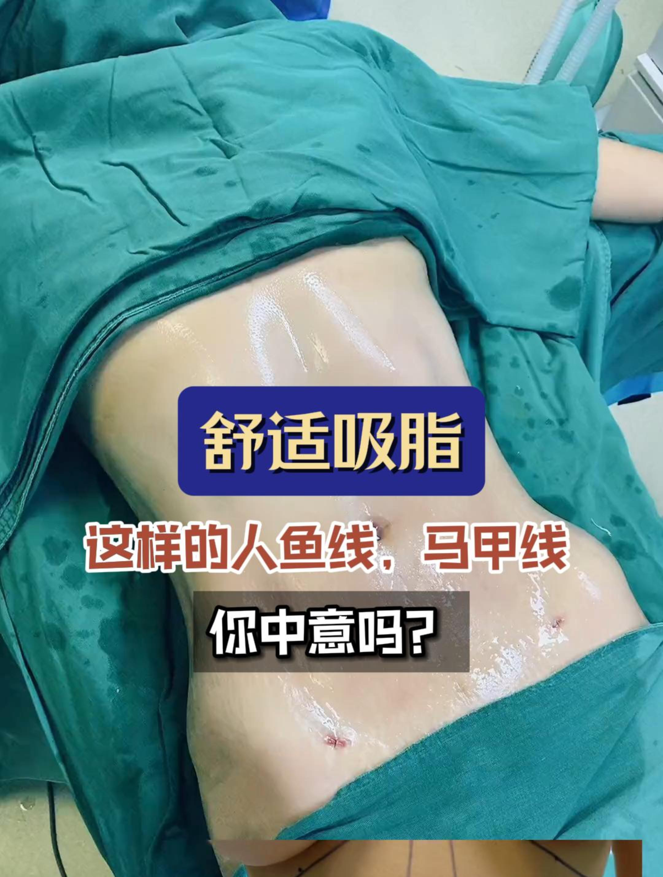 这样的人鱼线,马甲线 你中意吗?