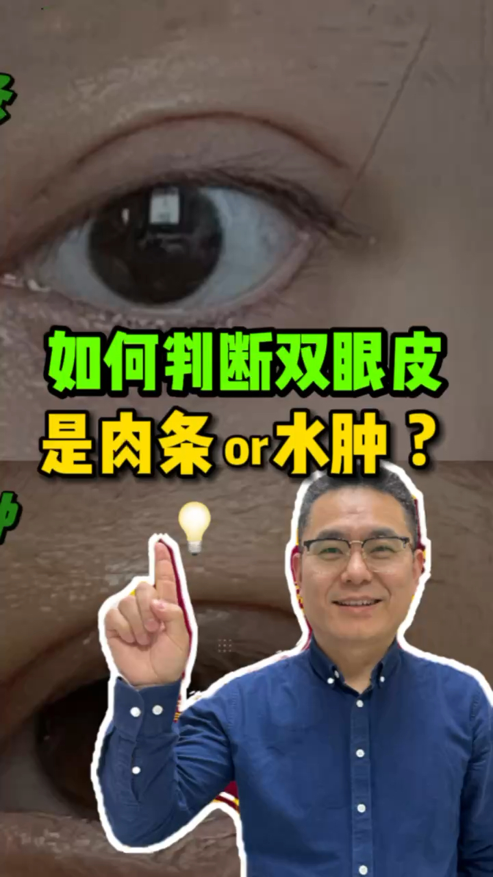 如何判断双眼皮是肉条还是水肿?