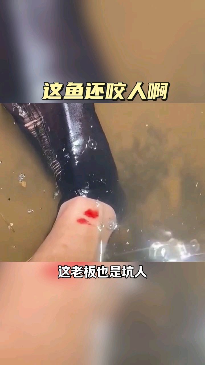 这鱼还咬人啊,太疼了