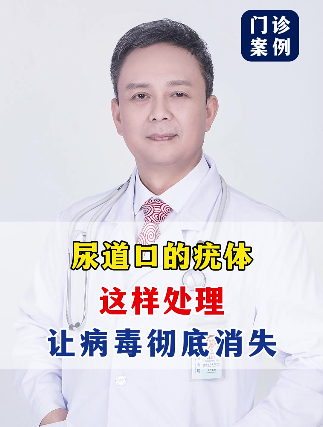 尿道口的疣体,这样处理,让病毒彻底消失