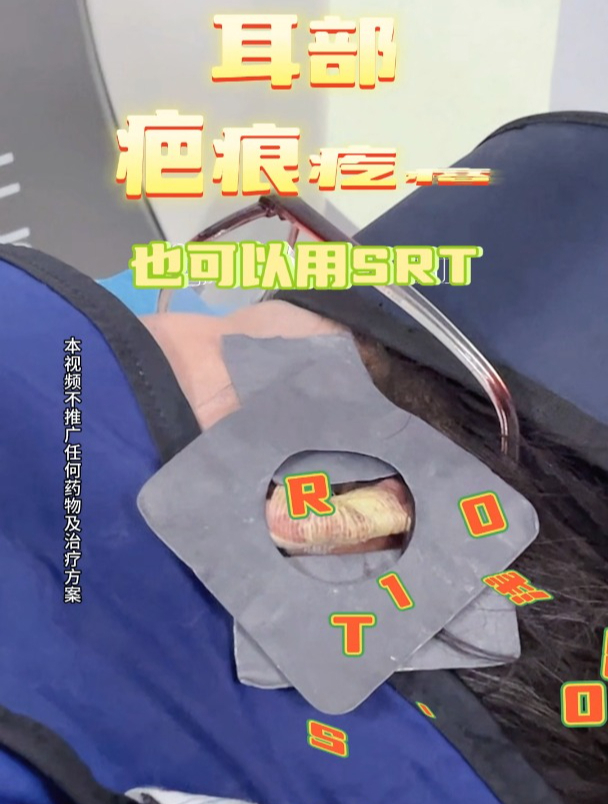 耳朵上长了明显的疤痕,小姑娘迫不及待想修复!