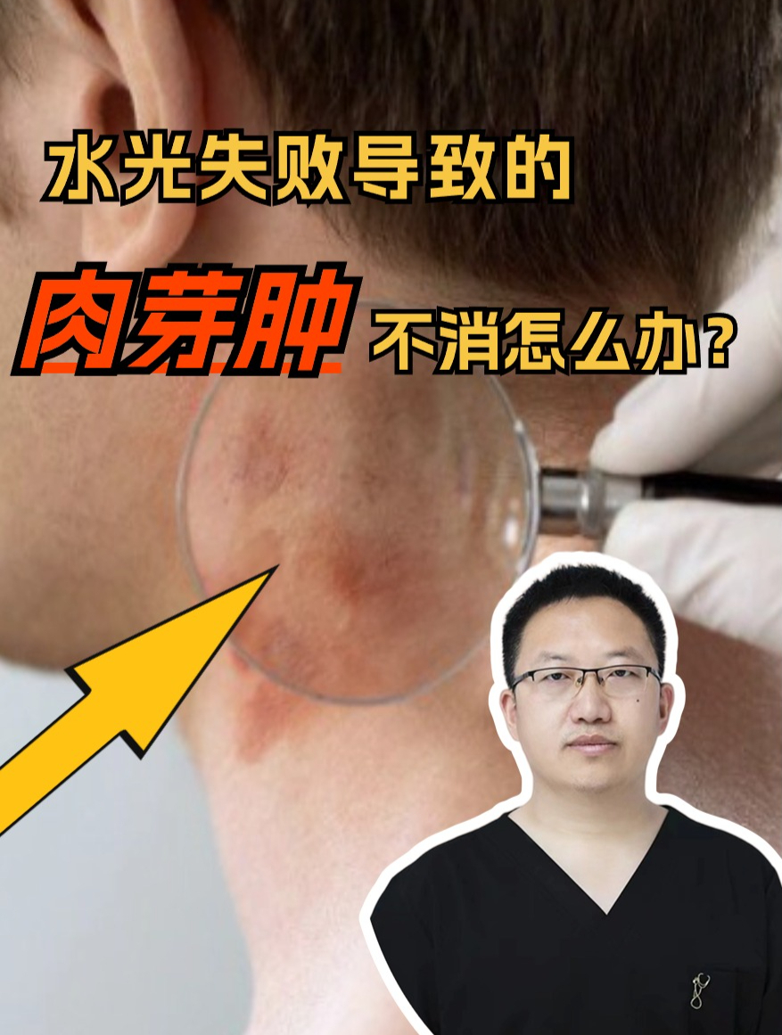 水光导致的肉芽肿一直不消怎么办?