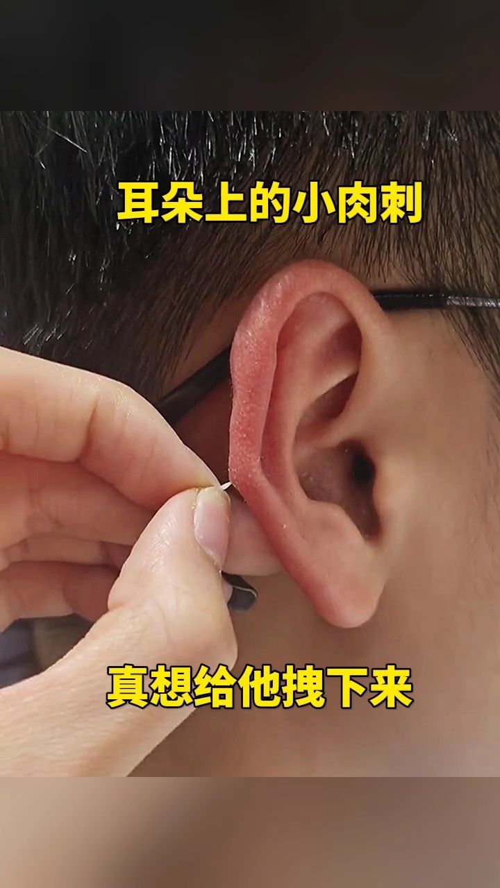 耳朵上的小肉刺,真想给他拽下来!