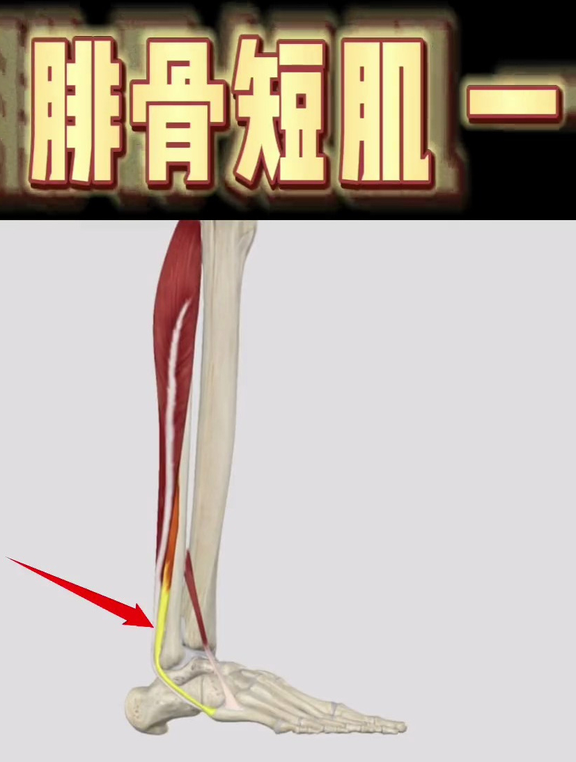 崴脚时需要评估的一块肌肉