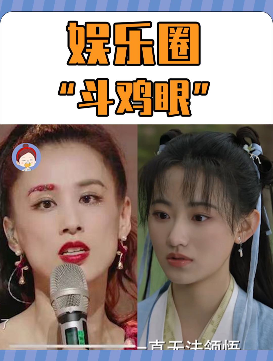 娱乐圈有斗鸡眼的明星