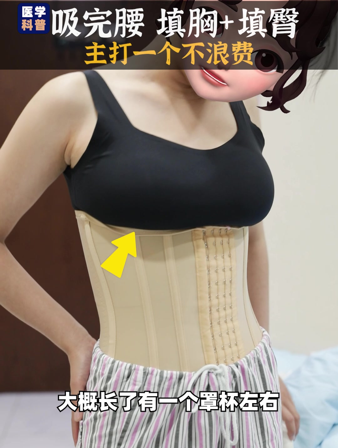 不浪费赘肉!腰腹吸出脂肪填充胸