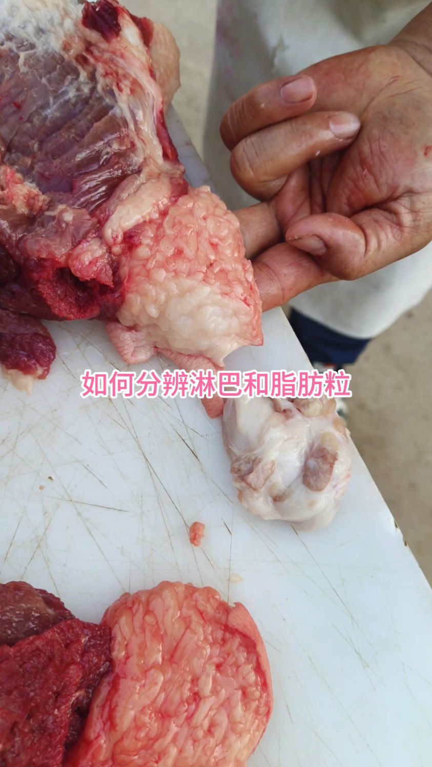 如何区分淋巴和脂肪粒