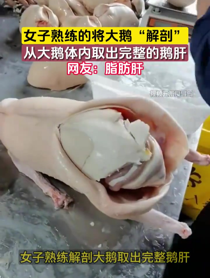 女子熟练的将大鹅“解剖”,从大鹅体内取出完整的鹅肝
