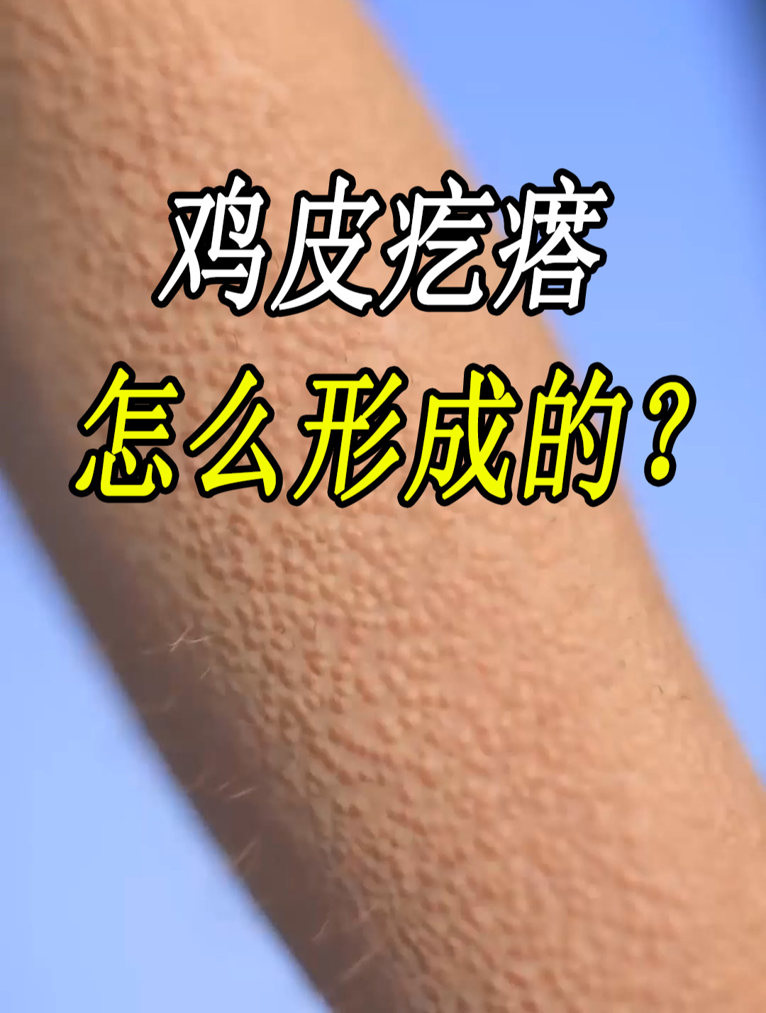 人类身体上的鸡皮疙瘩,是怎么形成的?有没有什么作用?