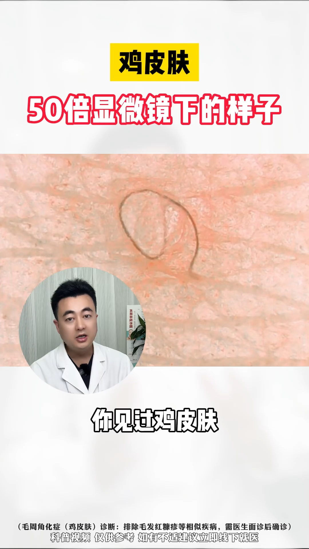 鸡皮肤在显微镜下 VS 手臂皮肤的样子,学会处理干净!