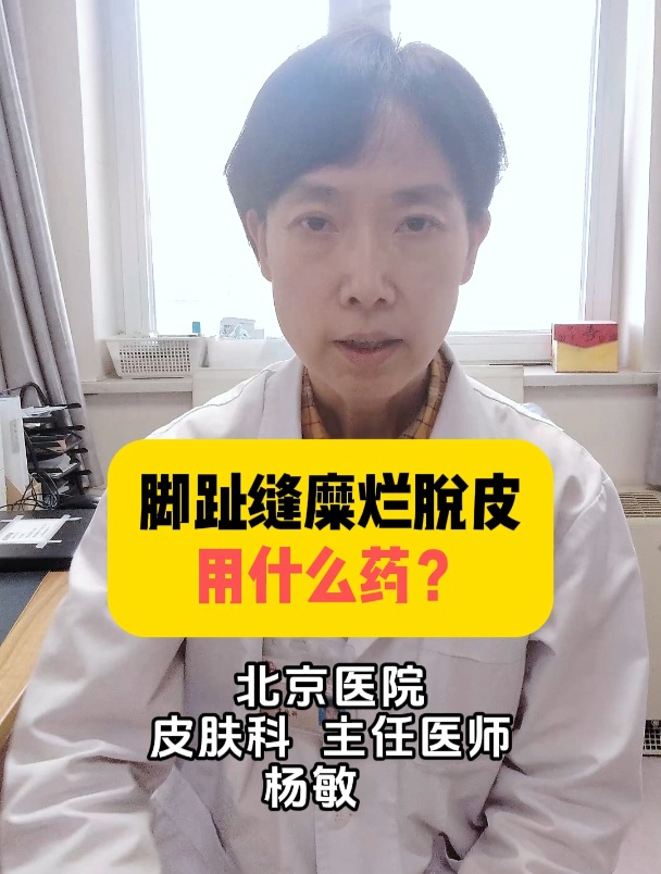 脚趾缝糜烂脱皮用什么药?