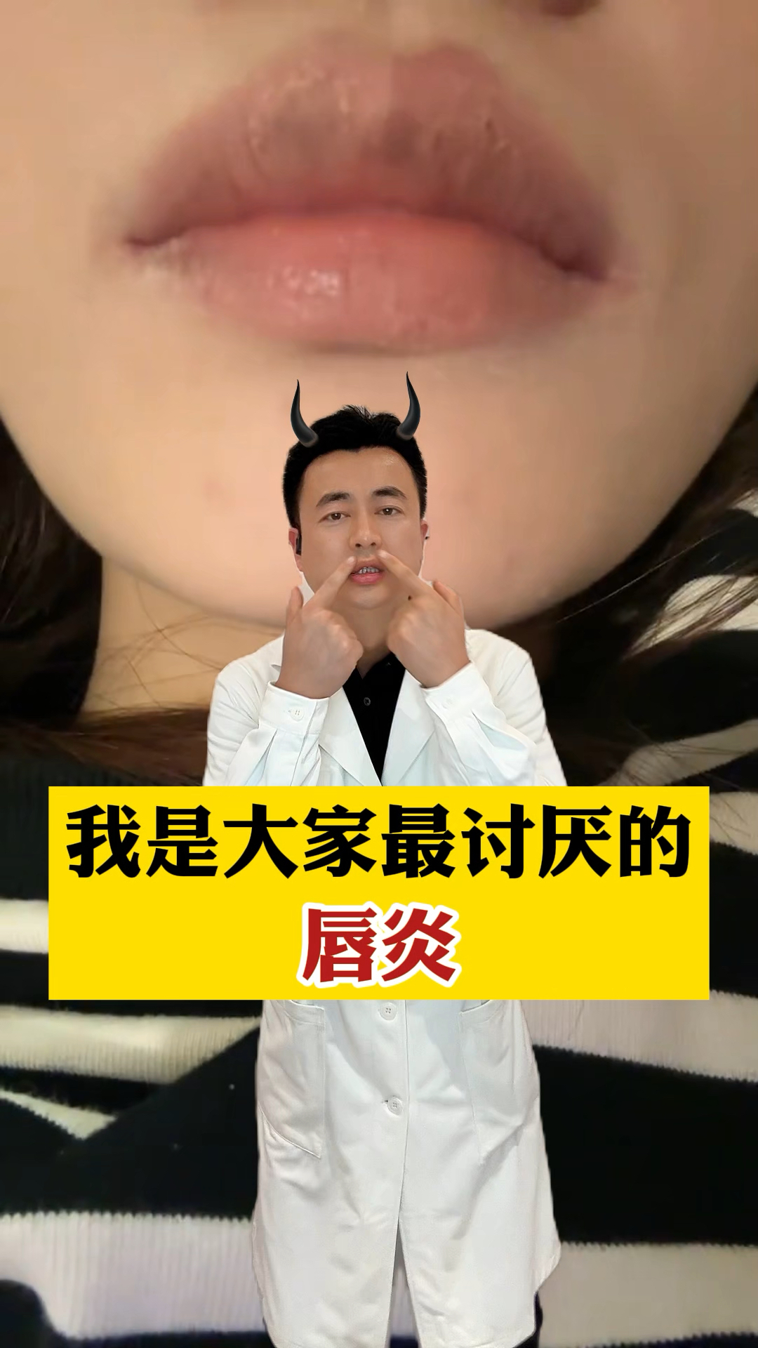 唇炎好烦人,医生教大家!